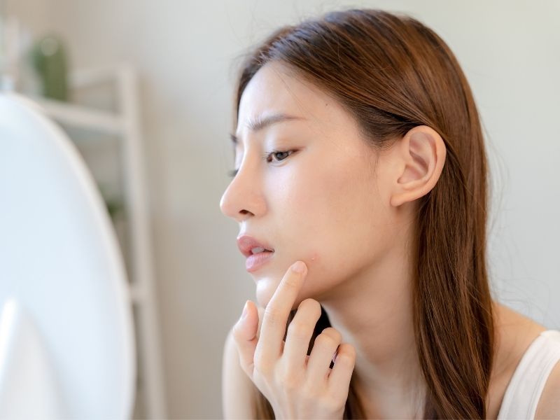 Anti-Inflammatory